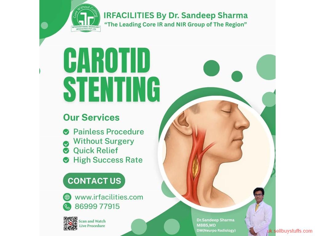 second hand/new: Benefits of Carotid Stent Treatment for Artery Blockage 