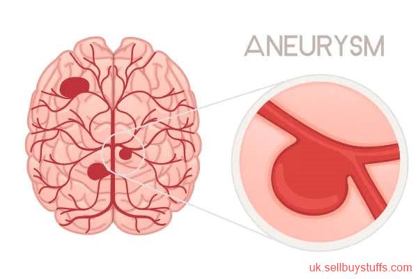 second hand/new: Advanced Aneurysm Endovascular Coiling for Safe & Minimally Invasive Brain Treatment
