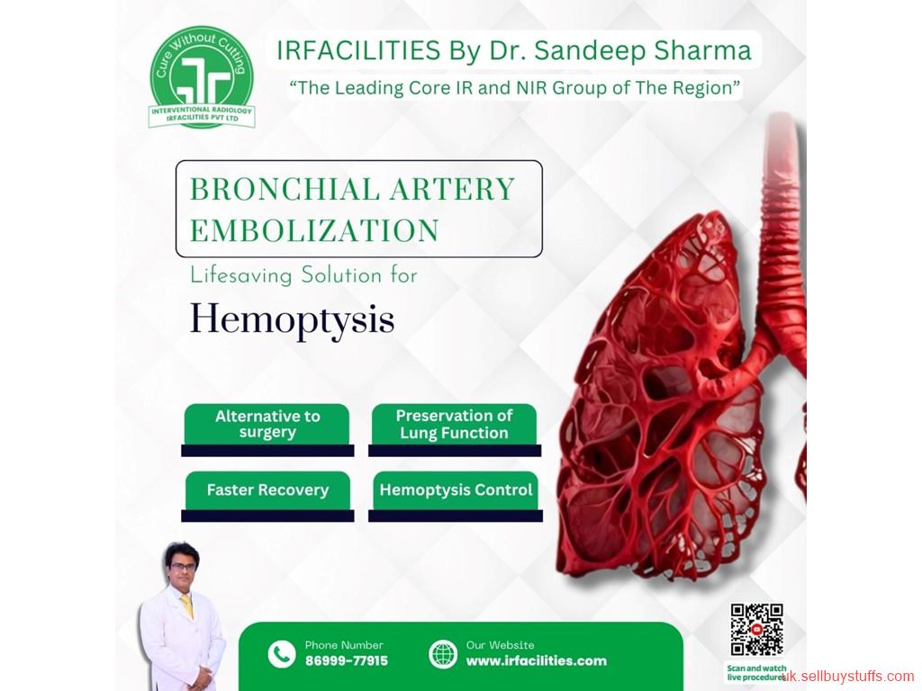 second hand/new: Advanced Bronchial Artery Embolization Technique in Treating Lung Hemorrhage
