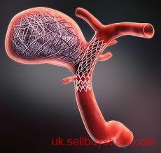 second hand/new: Aneurysm Coiling Procedure for Brain Aneurysm Care | IR Facilities